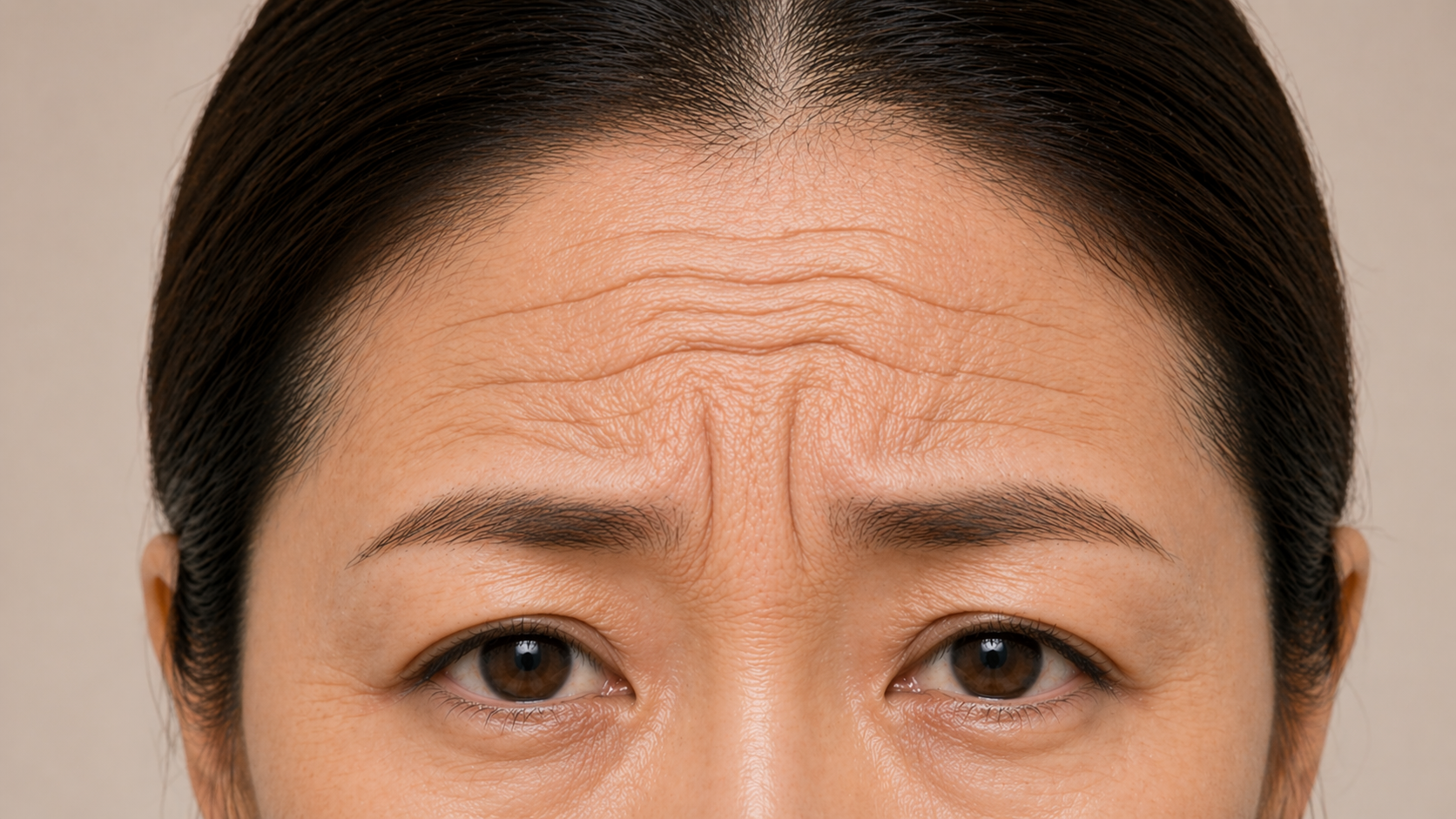 Anti-wrinkle-treatment