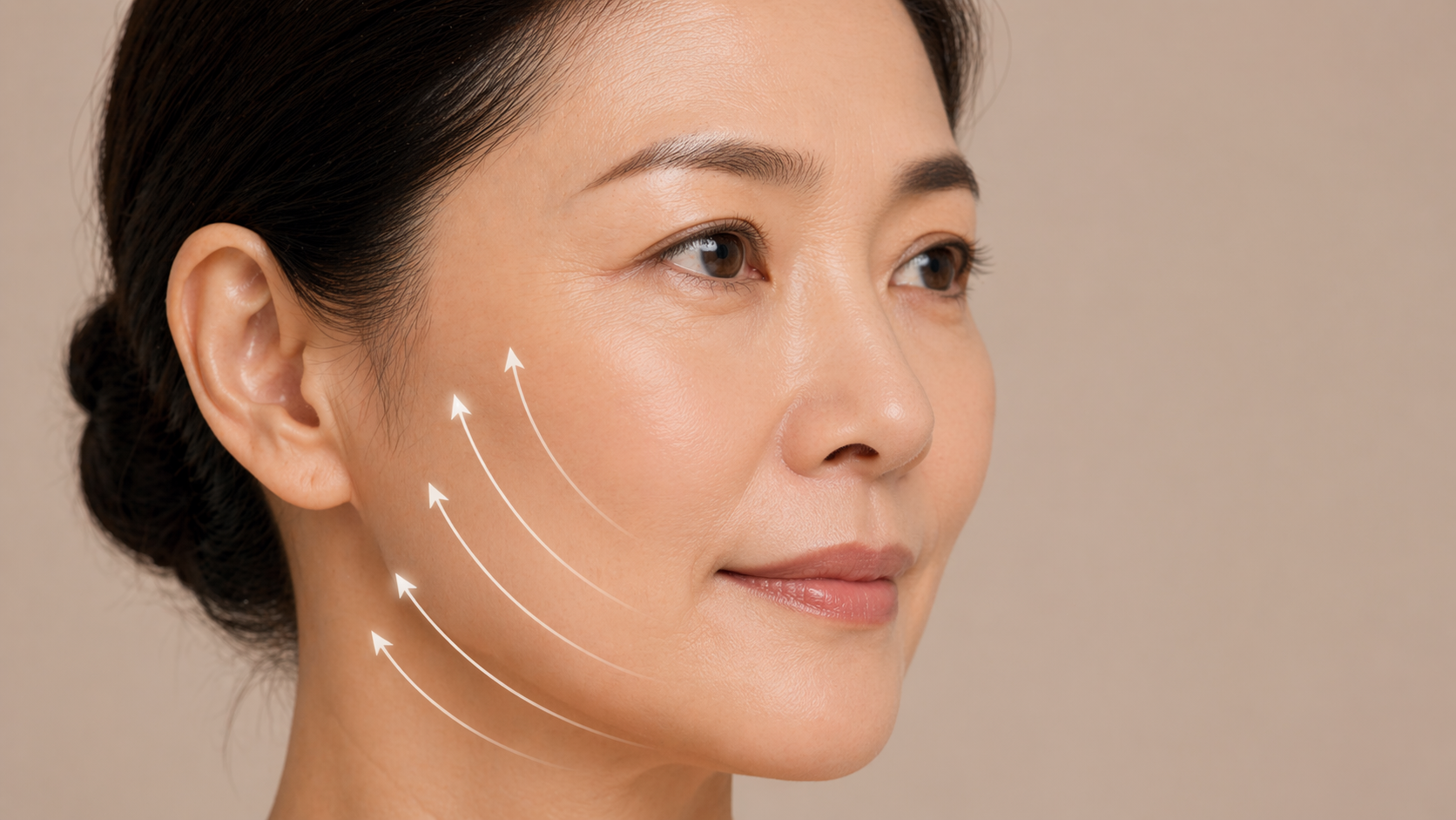 Anti-wrinkle-treatment